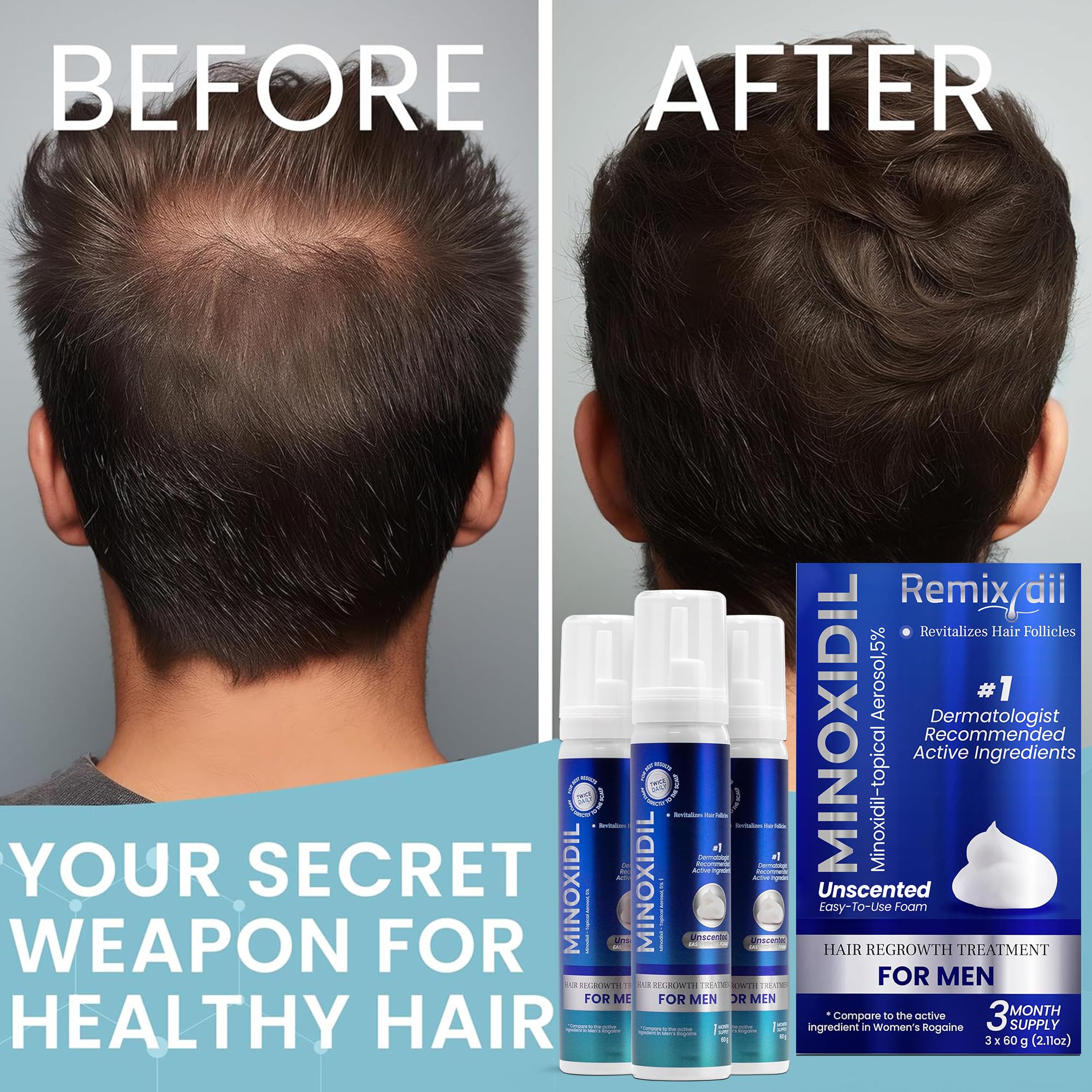 Rida Hair Remixidil foam in a daily routine setting for convenient use.