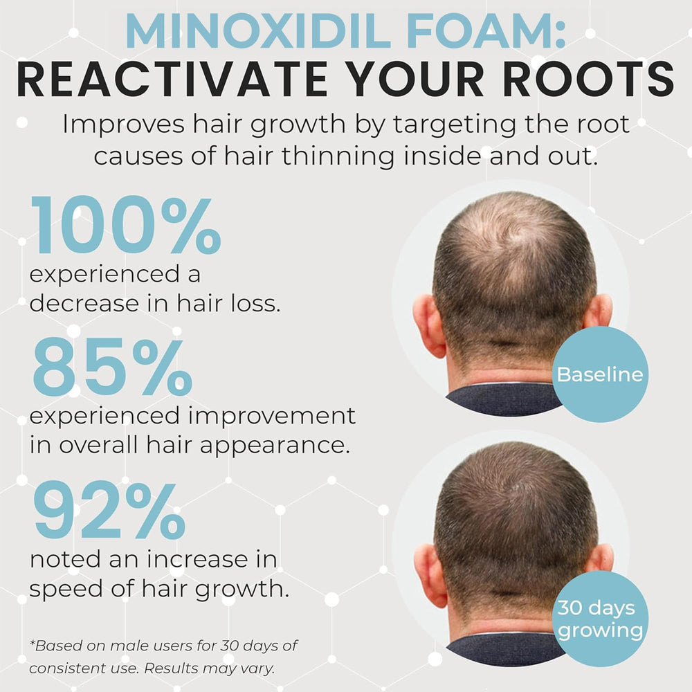 Rida Hair Remixidil foam packaging communicates clinical-quality care.