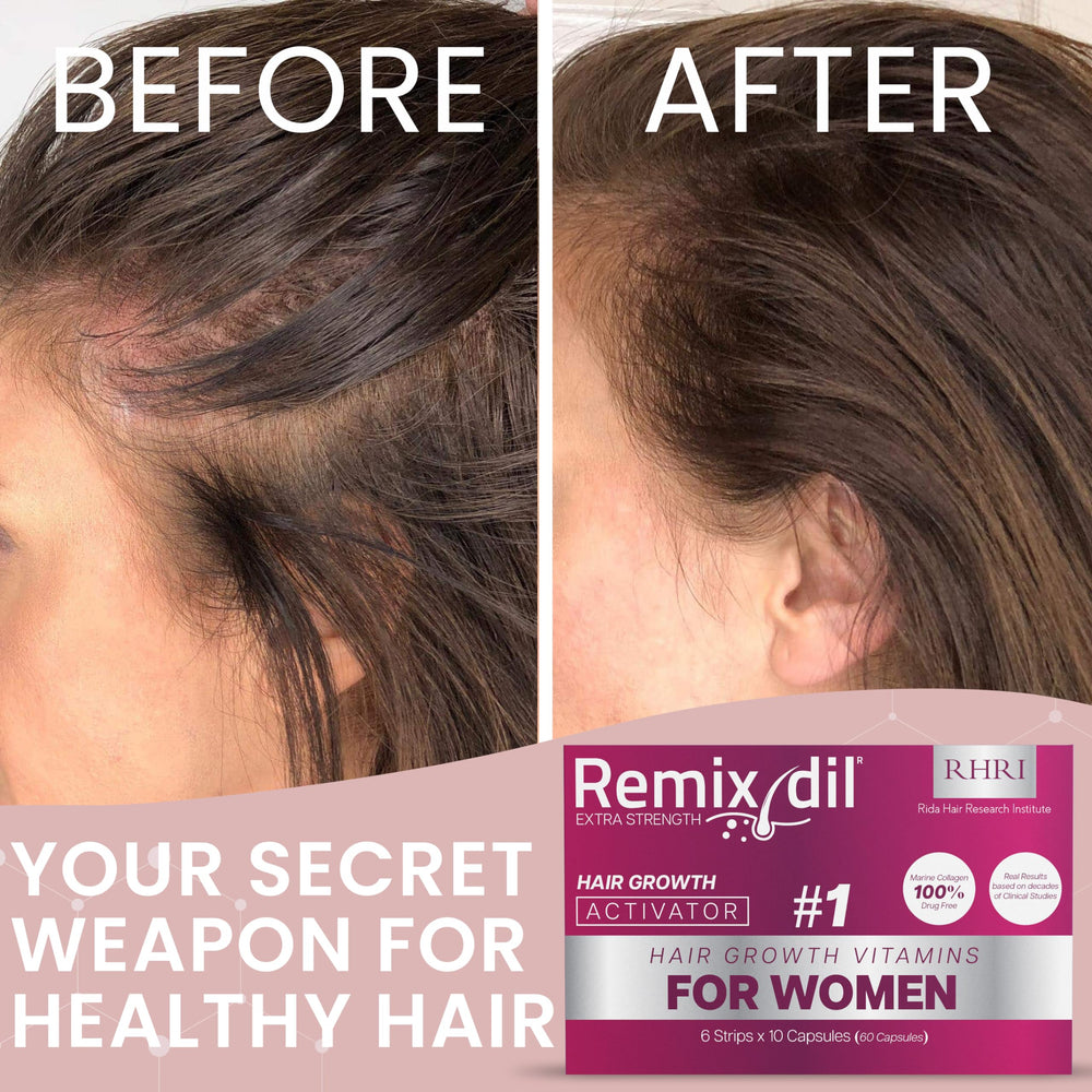 Remixidil bottle being poured demonstrates easy dosing in a daily regimen.