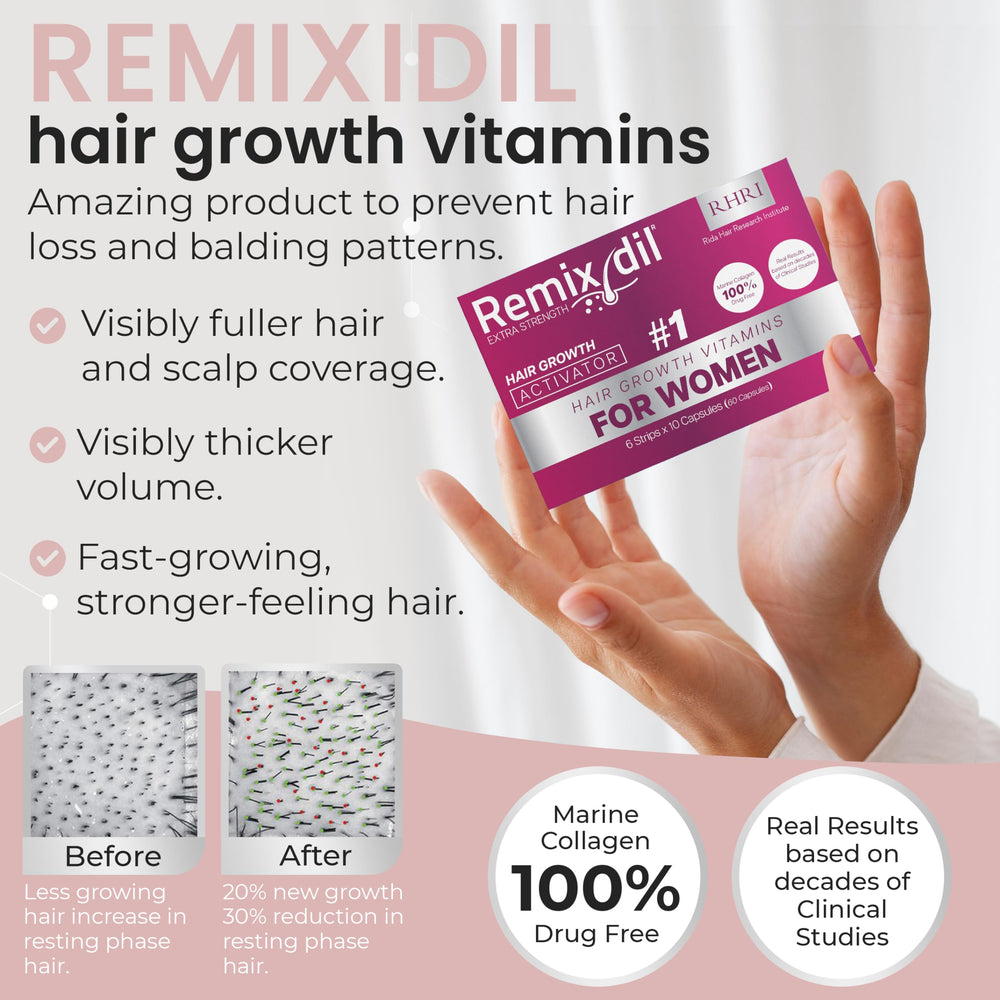 Remixidil scalp-health illustration emphasizes nourishing roots for a balanced scalp environment.