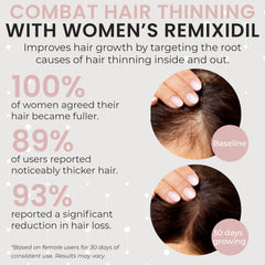 Remixidil thicker-hair visual hints at potential density with consistent use.