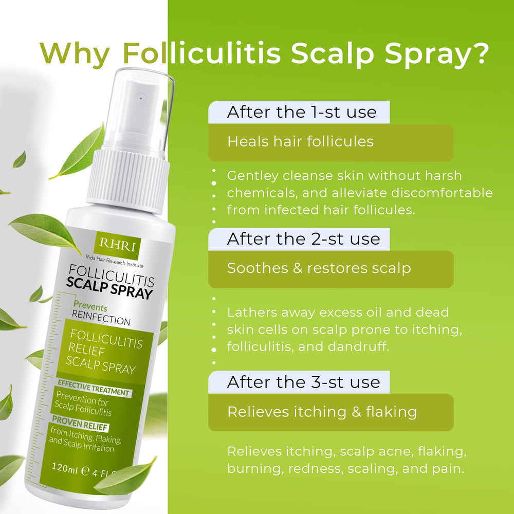 Rida Folliculitis Scalp Spray applied to scalp with soothing relief emphasis