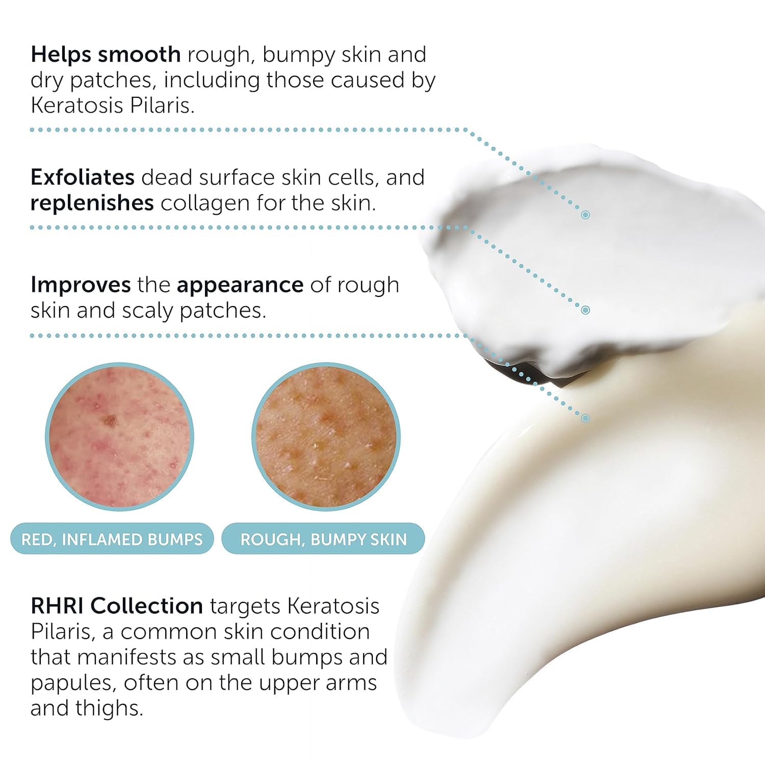 Rida KP Bump Eraser Body Lotion bottle delivering deep hydration.