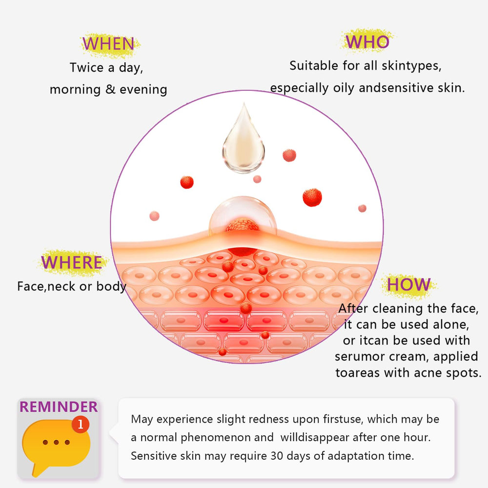 RIGBOO Ácido Azelaico 12% serum Centella Asiática, calma irritaciones leves.