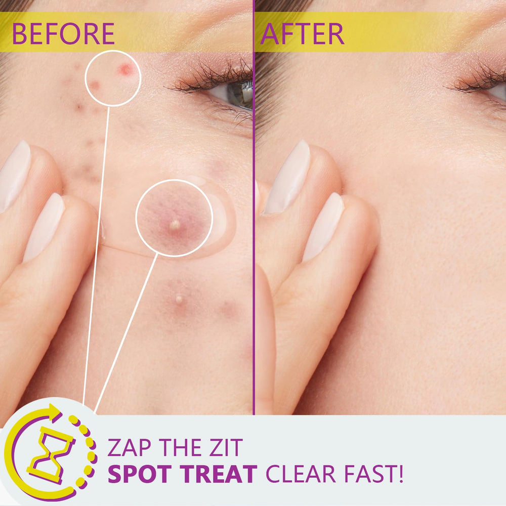 RIGBOO Ácido Azelaico 12% serum purifica poros y reduce brillos moderados.