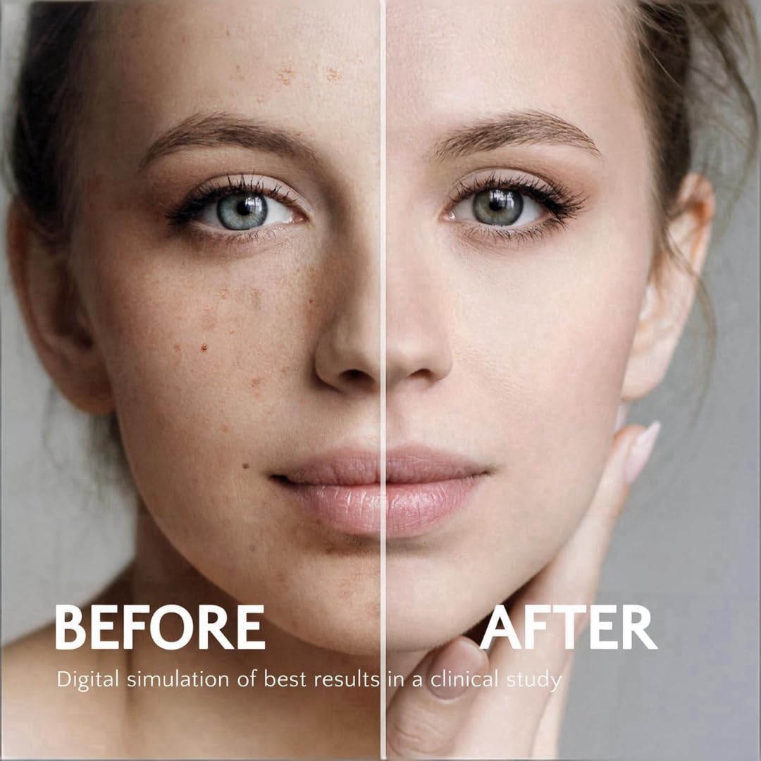 Vitamin E rich Rivocoda Hydraquinonol Cream visual emphasizing nourishment.
