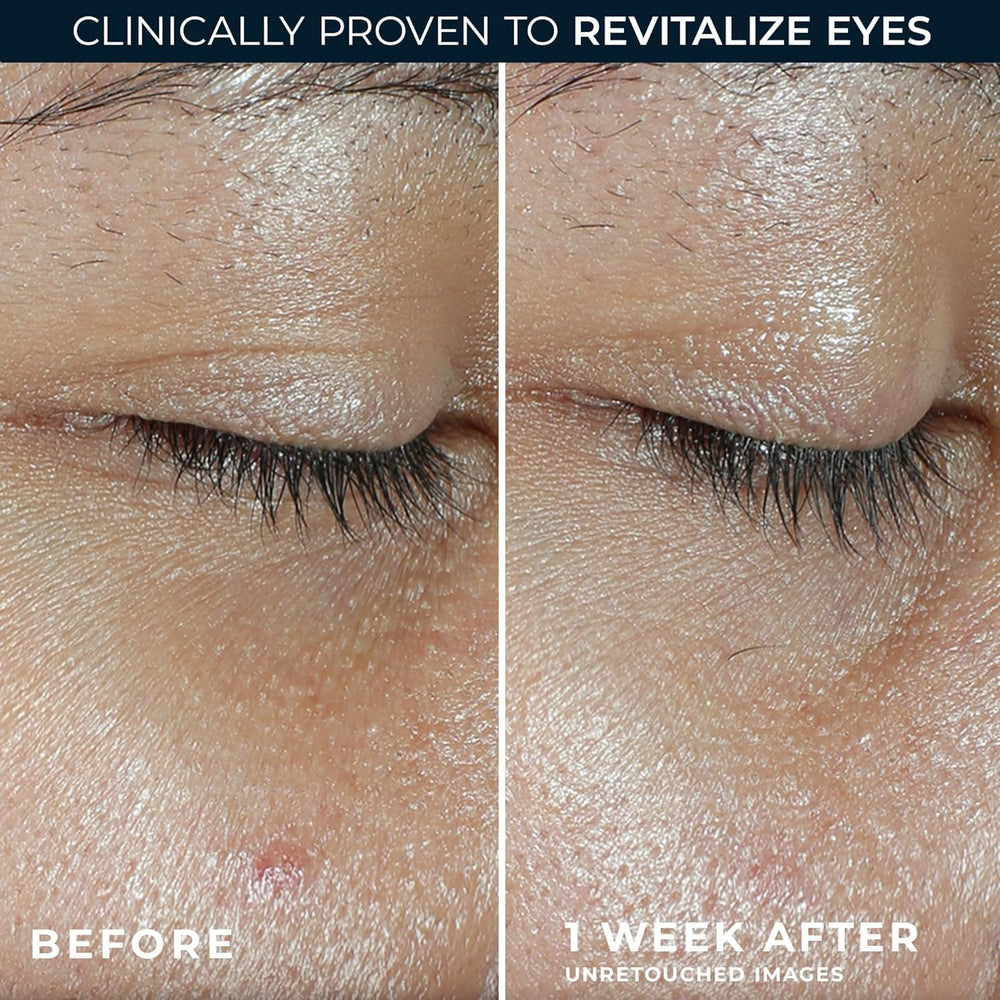 RoC brightening under-eye balm visual targets dark circles and puffiness