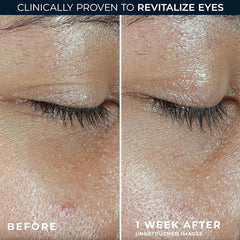 RoC brightening under-eye balm visual targets dark circles and puffiness