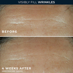 Dispense mechanism of RoC filler, controlled nightly application