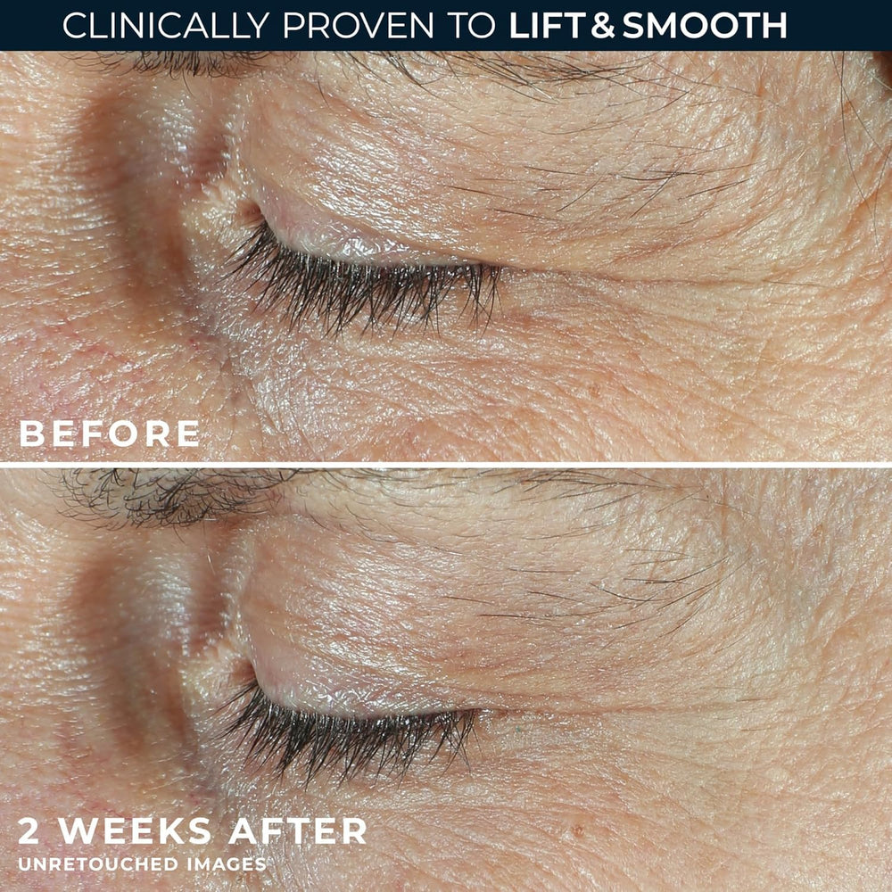 RoC Correxin eye care packette for two-step routine