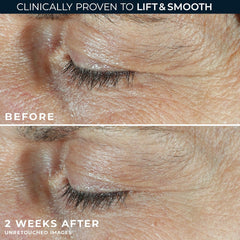 RoC Correxin eye care packette for two-step routine