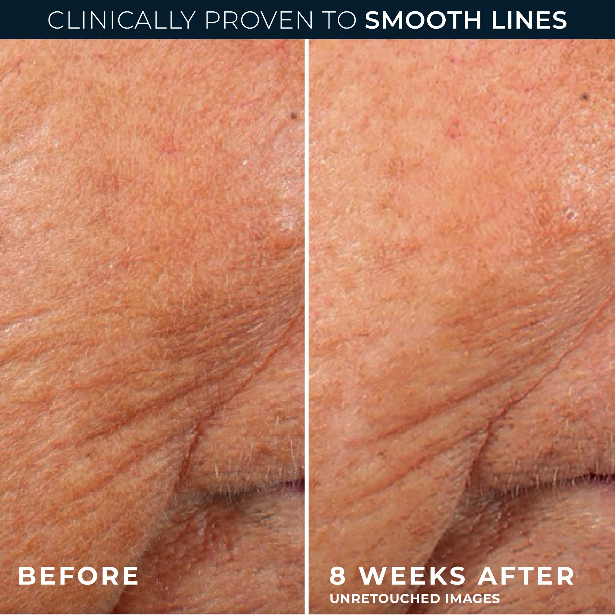 RoC Retinol Correxion daily-use routine image suggests simple night-time steps.