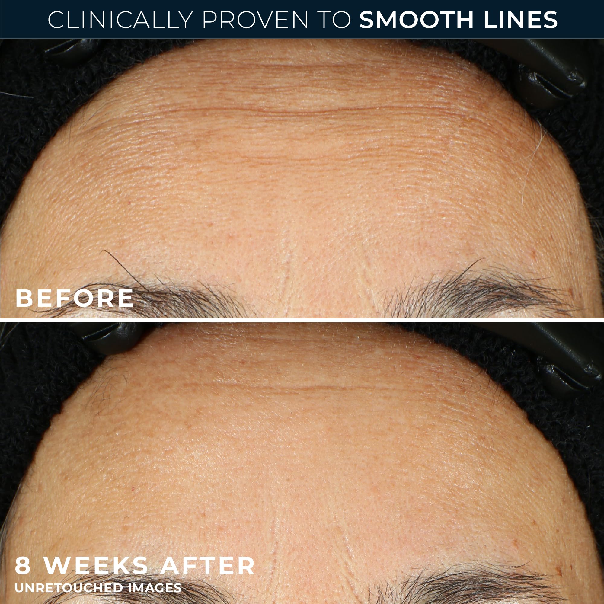 RoC Retinol Correxion foil-sealed capsules ensure freshness for nightly use.