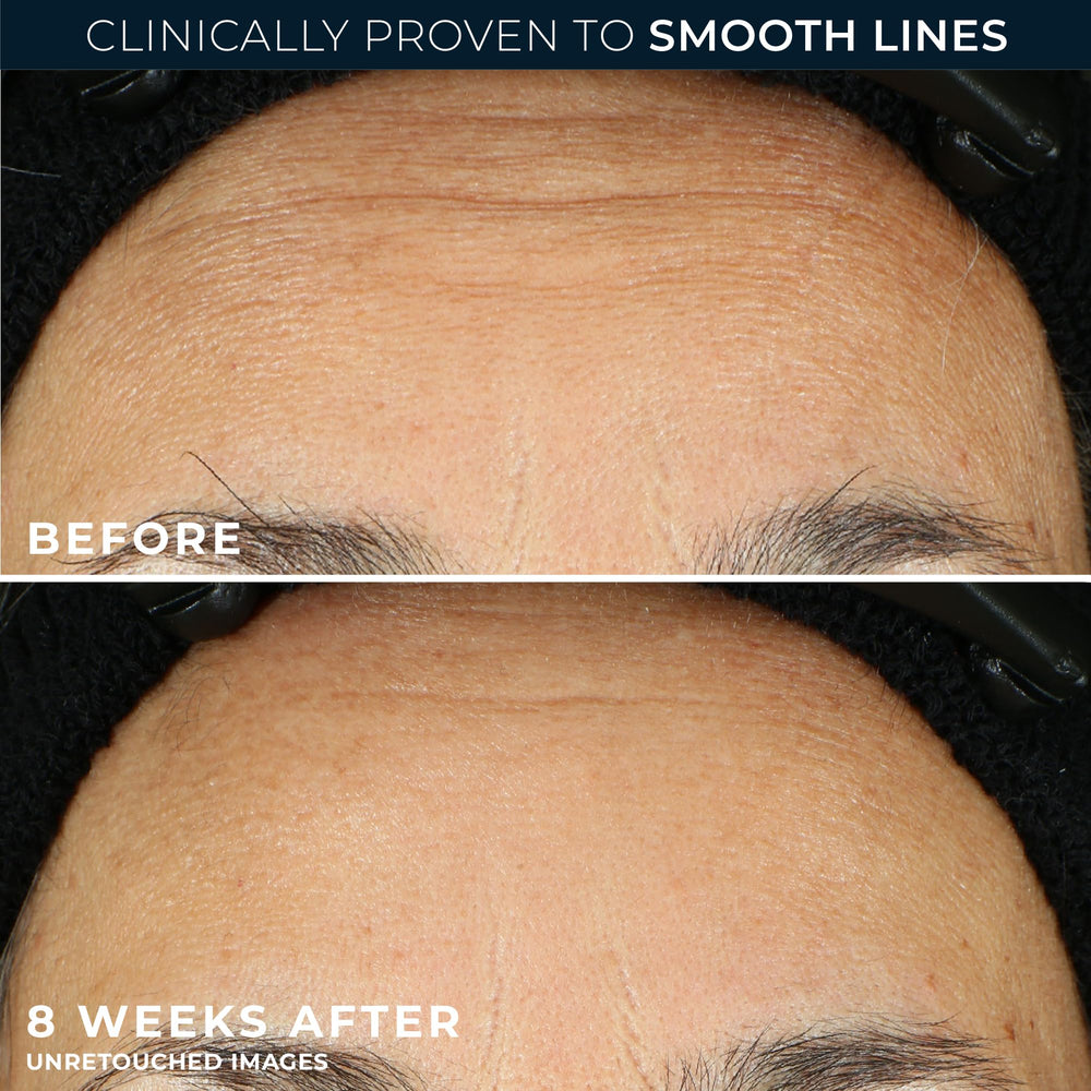 RoC Retinol Correxion foil-sealed capsules ensure freshness for nightly use.