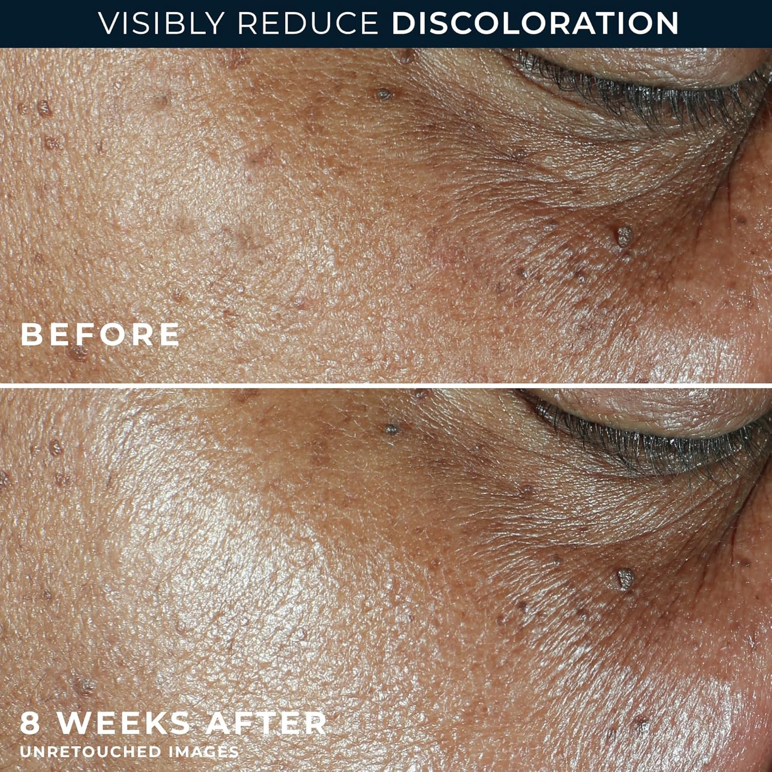 Close-up of RoC cream texture for smooth glide and quick absorption.