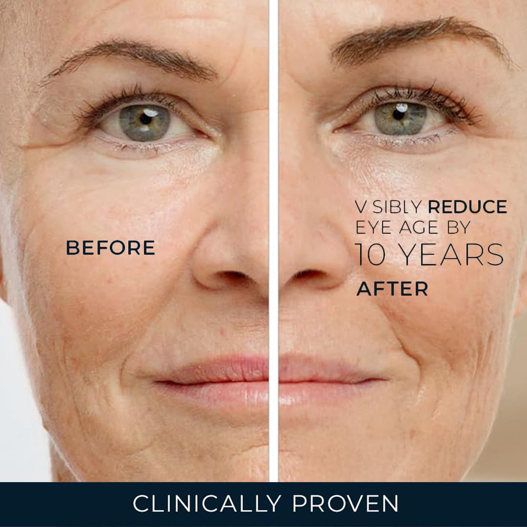 Aplicación diaria de RoC crema de ojos retinol en piel sensible