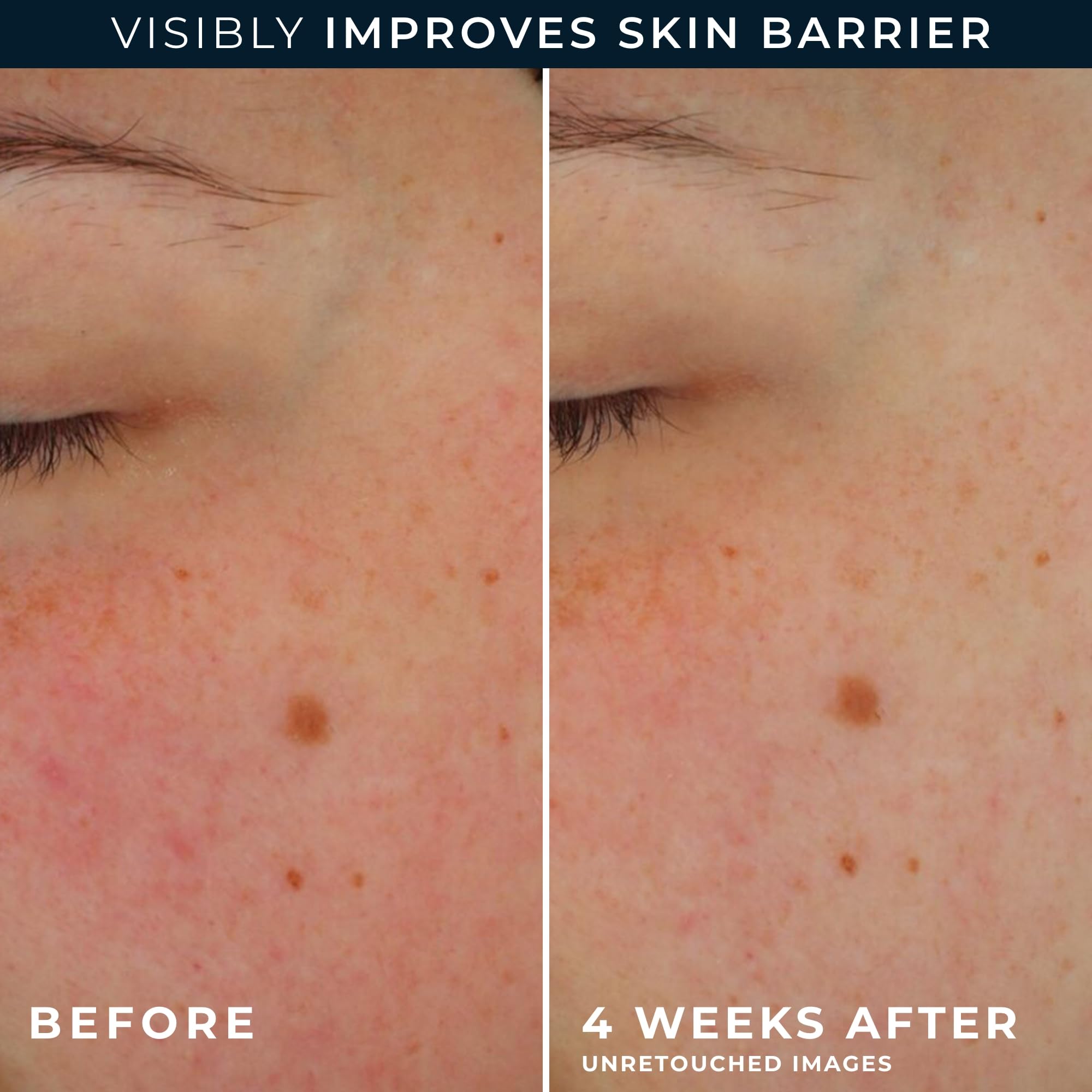 RoC crema de ojos con retinol Packette para el contorno