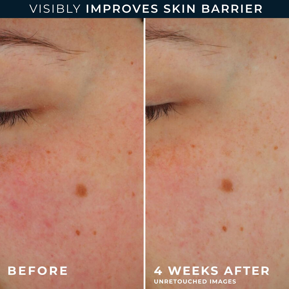 RoC crema de ojos con retinol Packette para el contorno