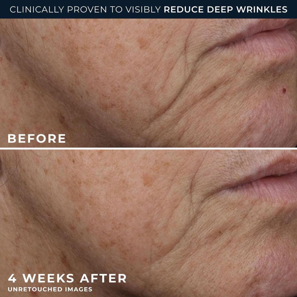 RoC Eye Cream Packette demonstrates compact, easy-to-use eye treatment.