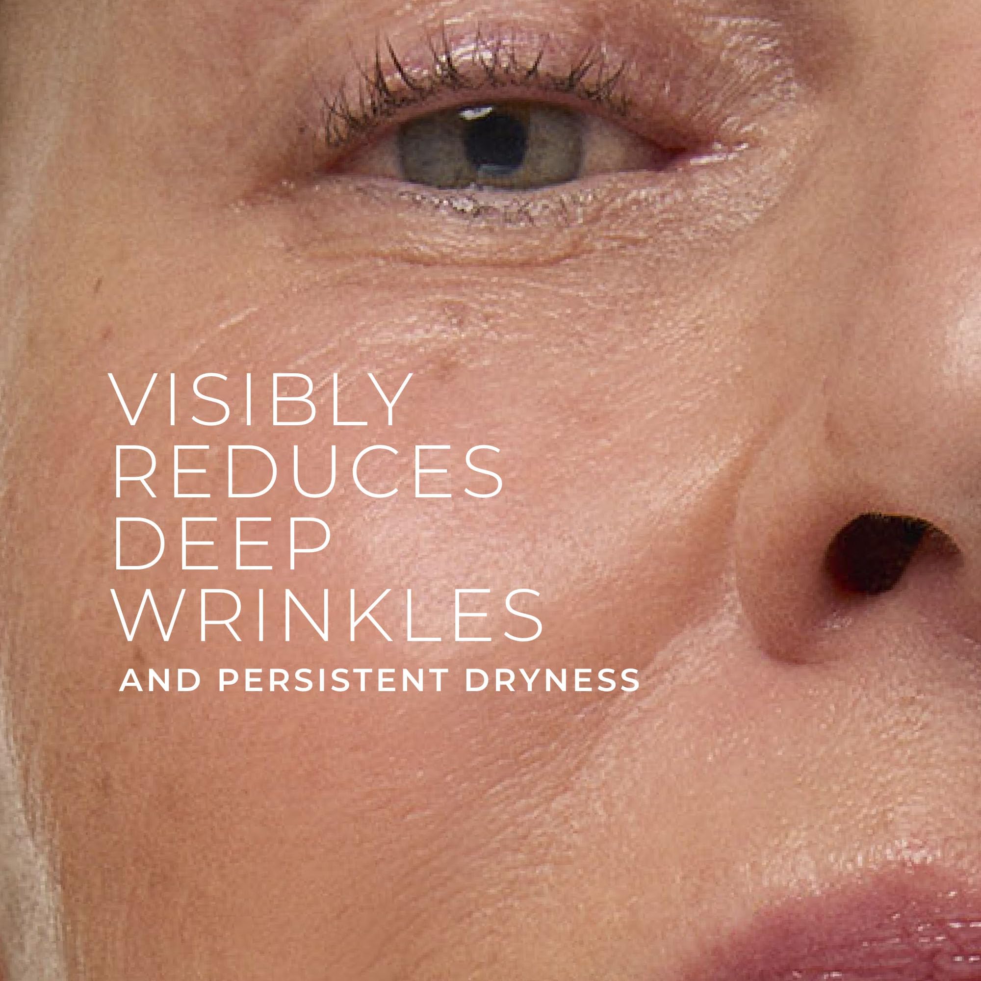 RoC Deep Wrinkle Rich Cream jar side label highlights Retinol-7x and Bio-Ceramides.