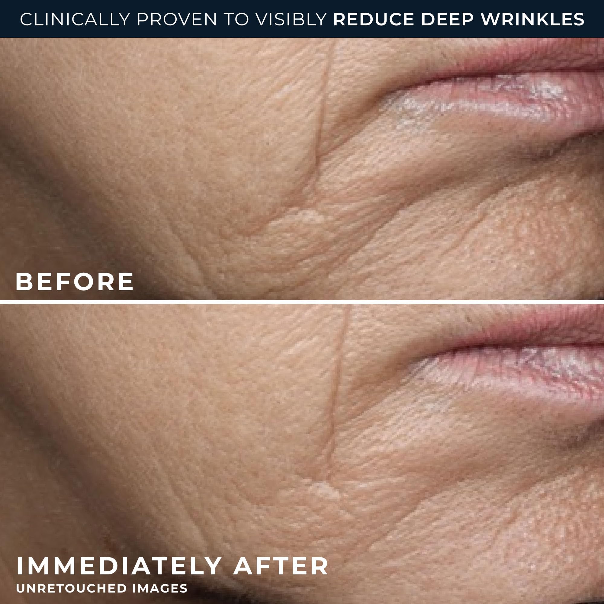 RoC Deep Wrinkle Rich Cream close-up texture shows rich, hydrating consistency.