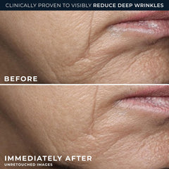 RoC Deep Wrinkle Rich Cream close-up texture shows rich, hydrating consistency.