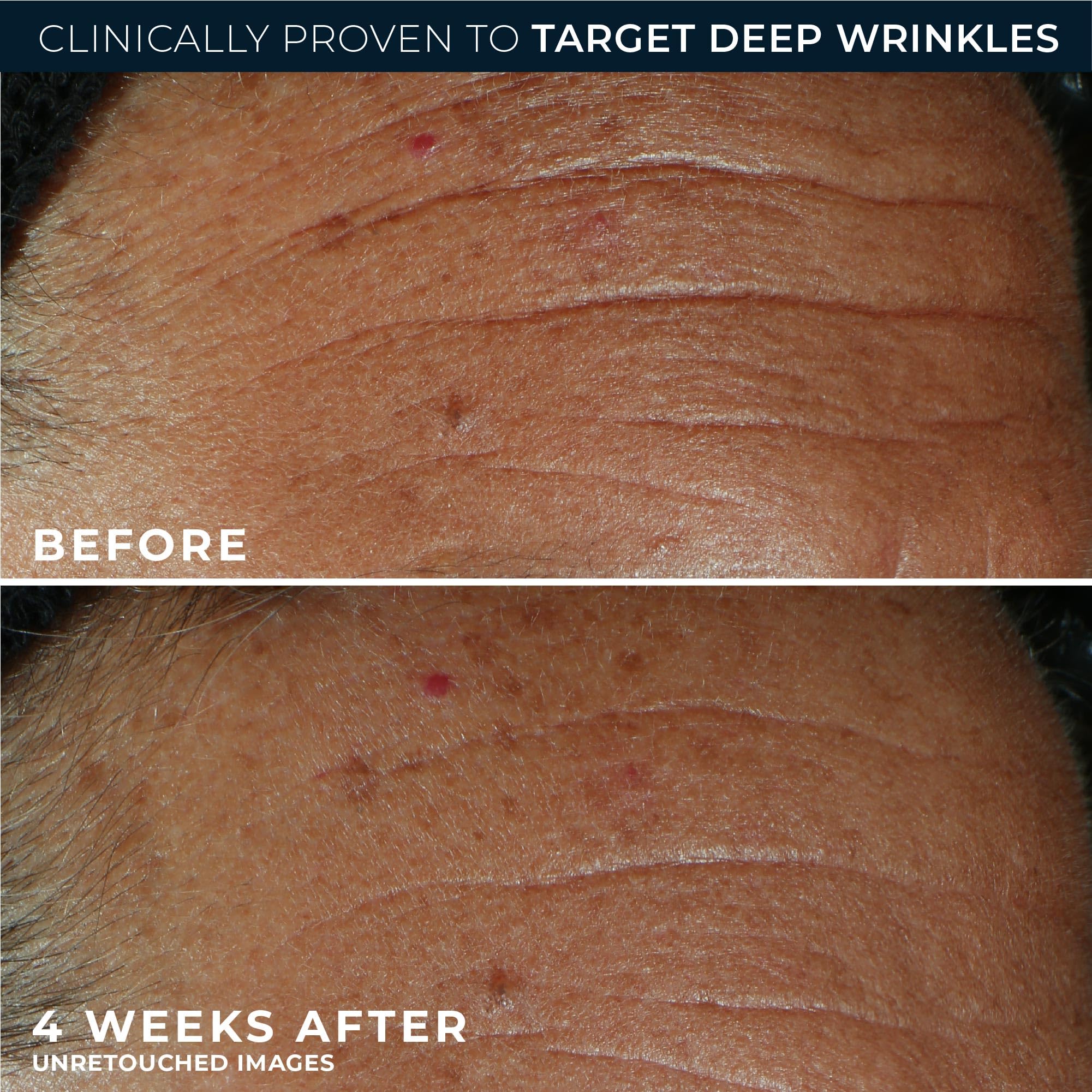 RoC Derm Correxion Fill + Treat serum in use on hand demonstrates fast absorption.