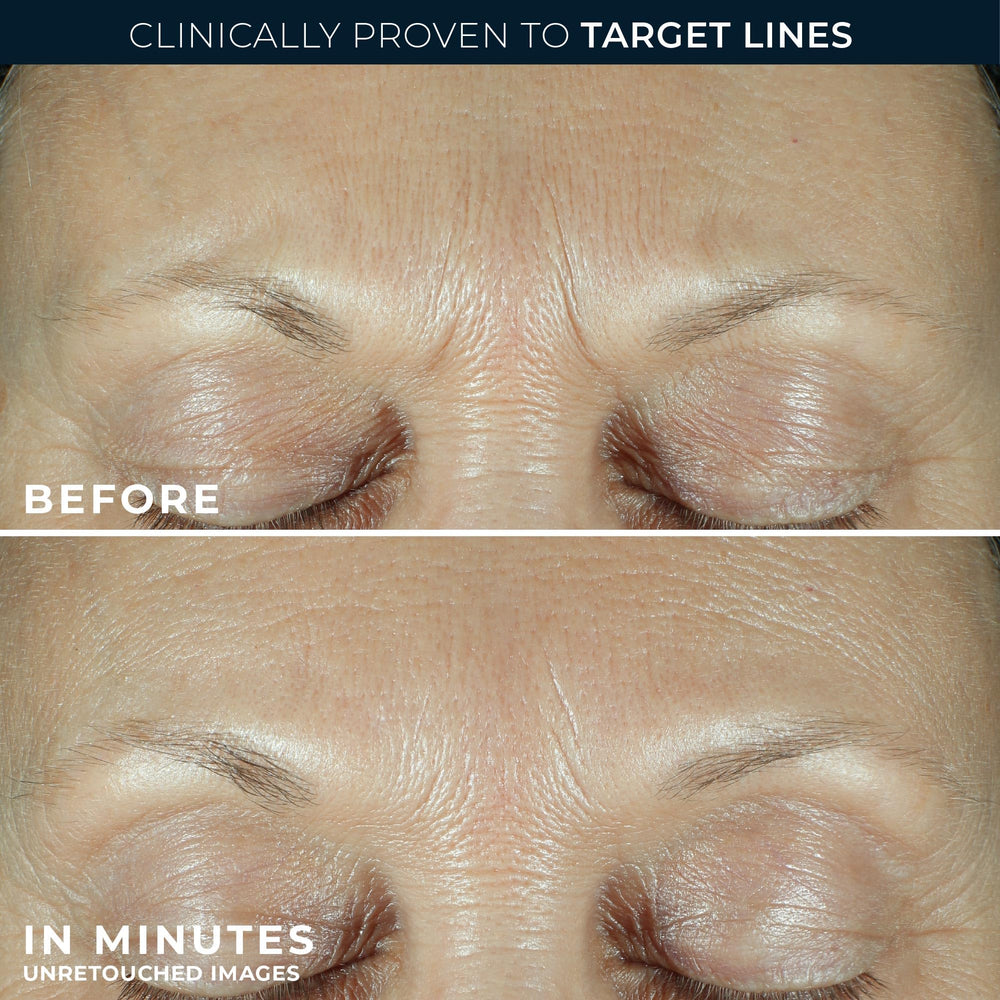 RoC Derm Correxion serum bottle emphasizes triple hyaluronic acid hydration.