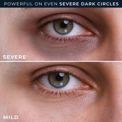 Grey-tones targeting with RoC formula for a more even under-eye look