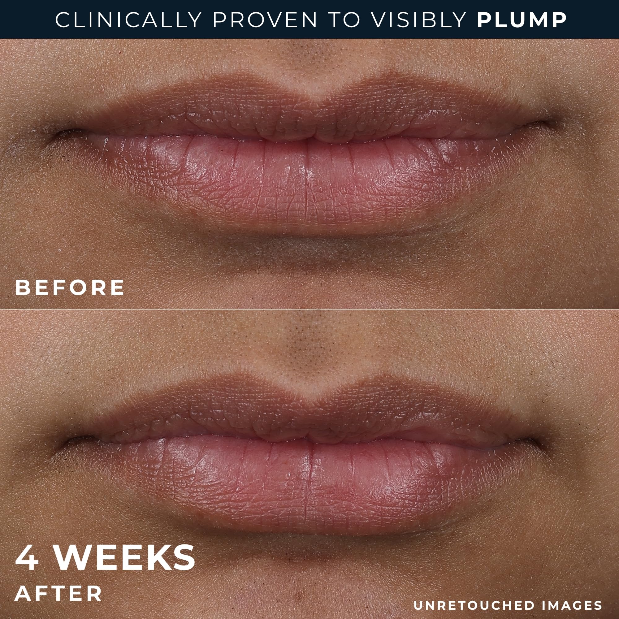 Travel-friendly RoC Lip Volumizer outer packette for on-the-go care