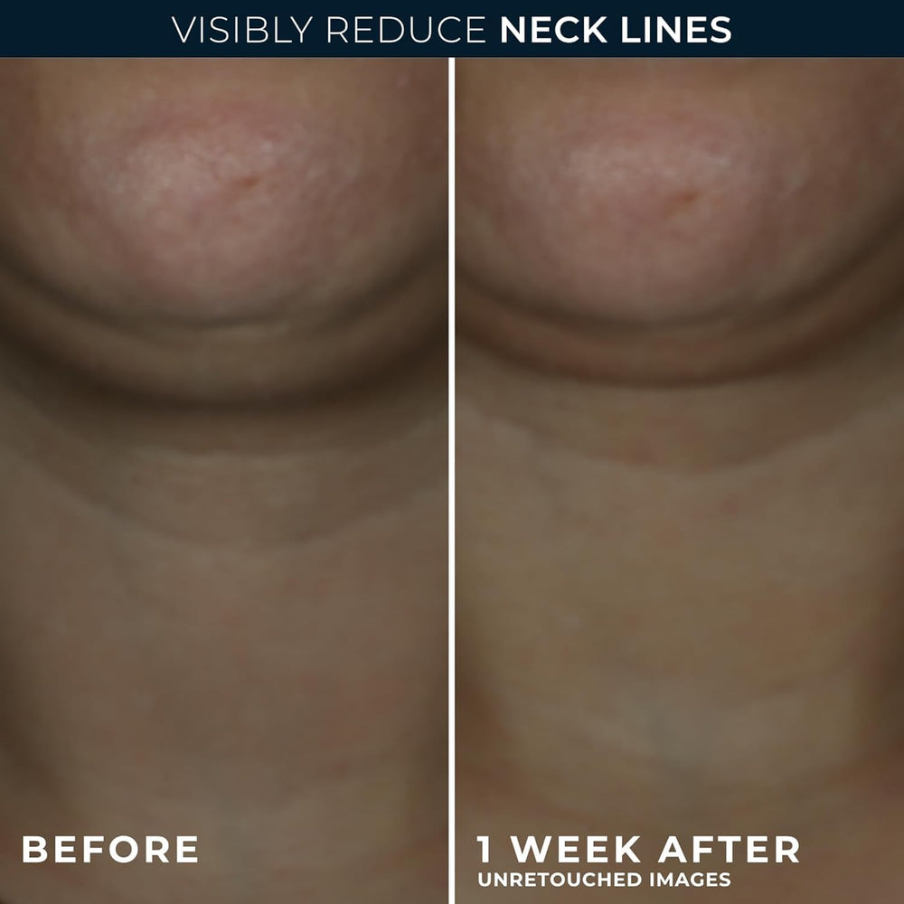 RoC neck cream with advanced retinol for firmer, lifted-looking skin.
