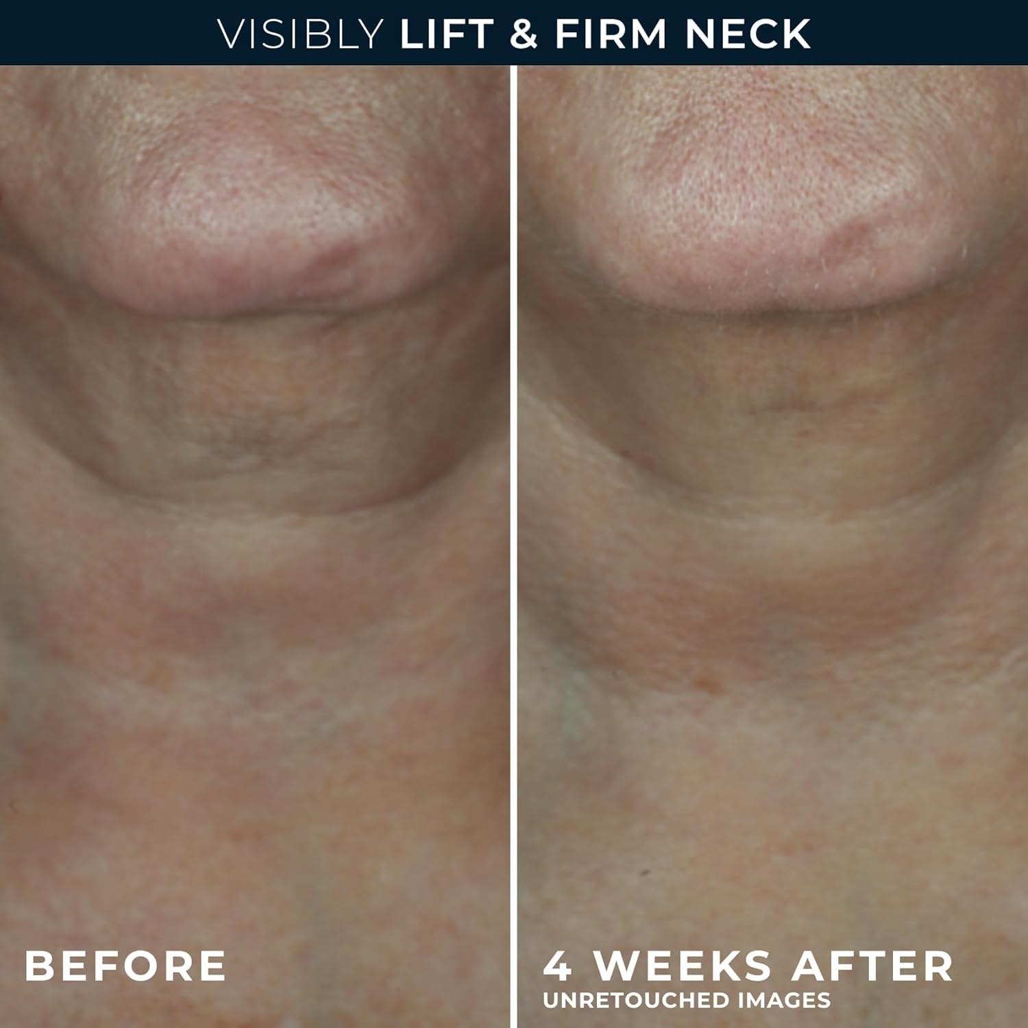 RoC neck cream with swertiamarin to boost moisture and contour.