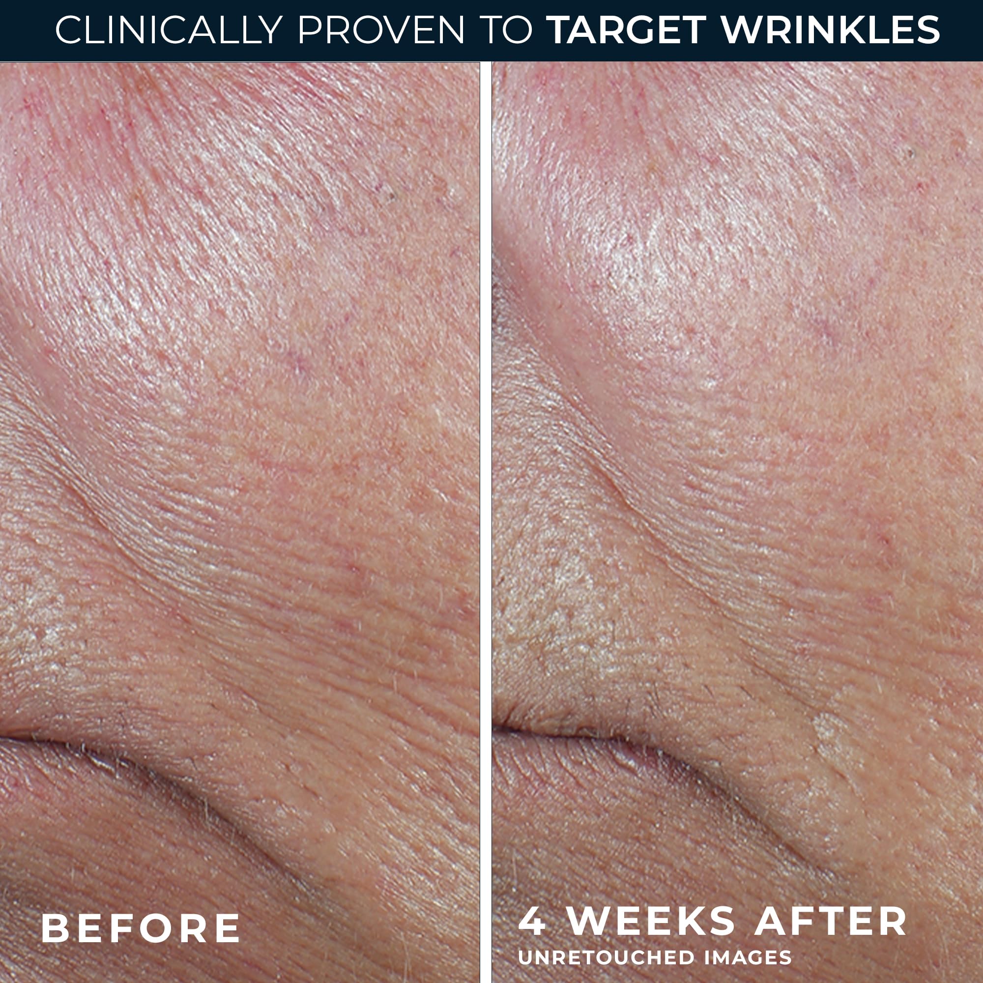 RoC Derm Correxion Retinol Firming Serum Stick applied to cheeks for lifting effect.