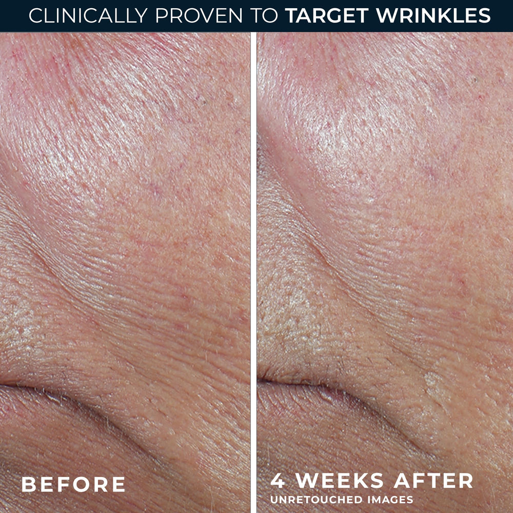 RoC Derm Correxion Retinol Firming Serum Stick applied to cheeks for lifting effect.