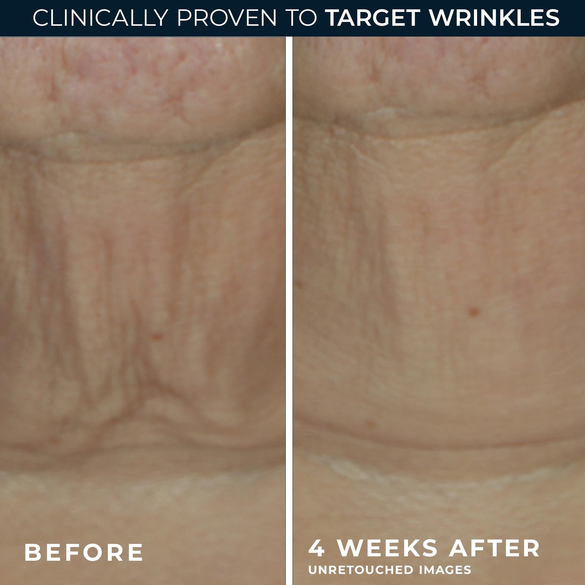 RoC Derm Correxion Retinol Firming Serum Stick boosts smoothing around expression lines.