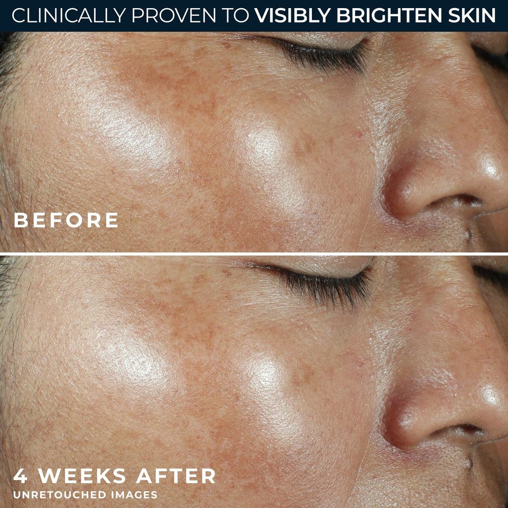 RoC eye cream hydrates and refreshes the eye area.