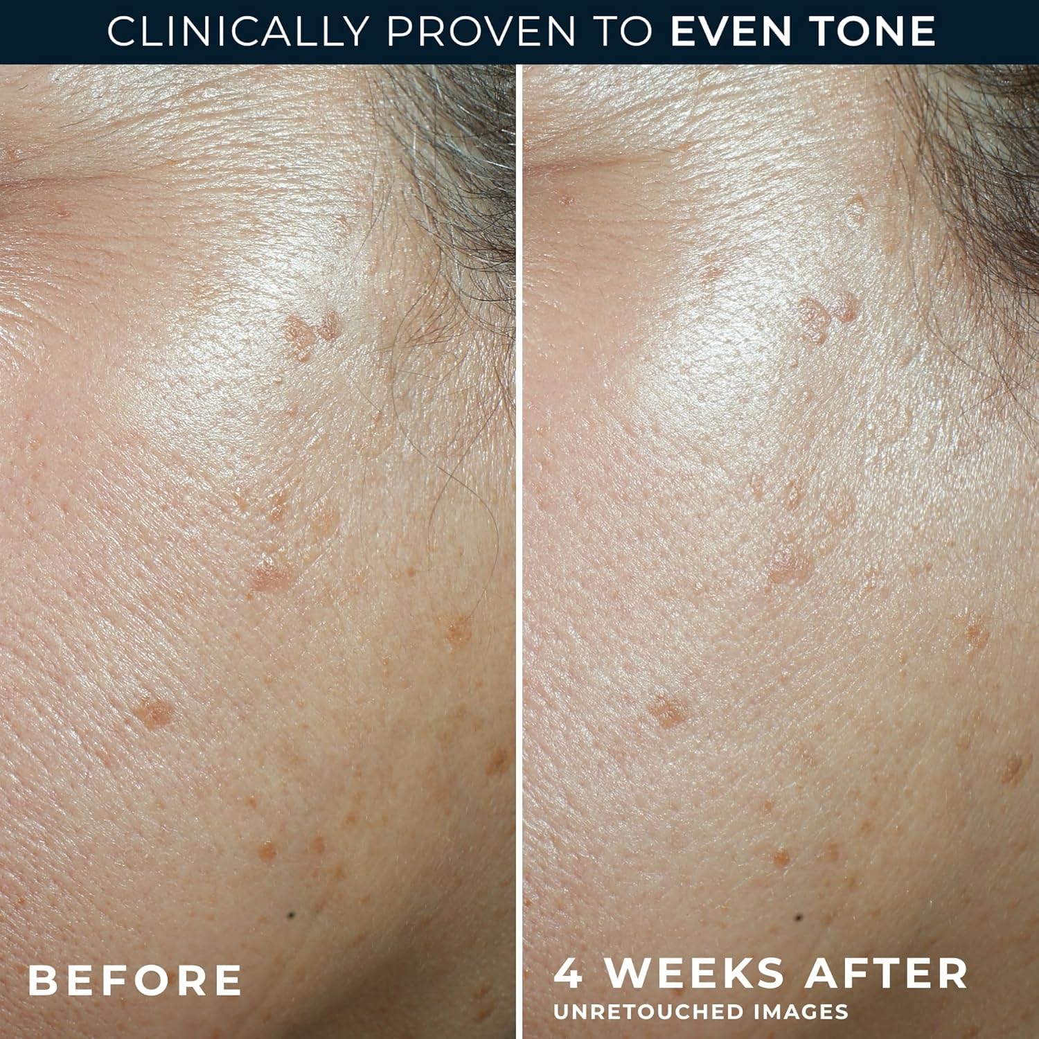 RoC Hexyl-Resorcinol complex ingredient close-up targets dark spots.