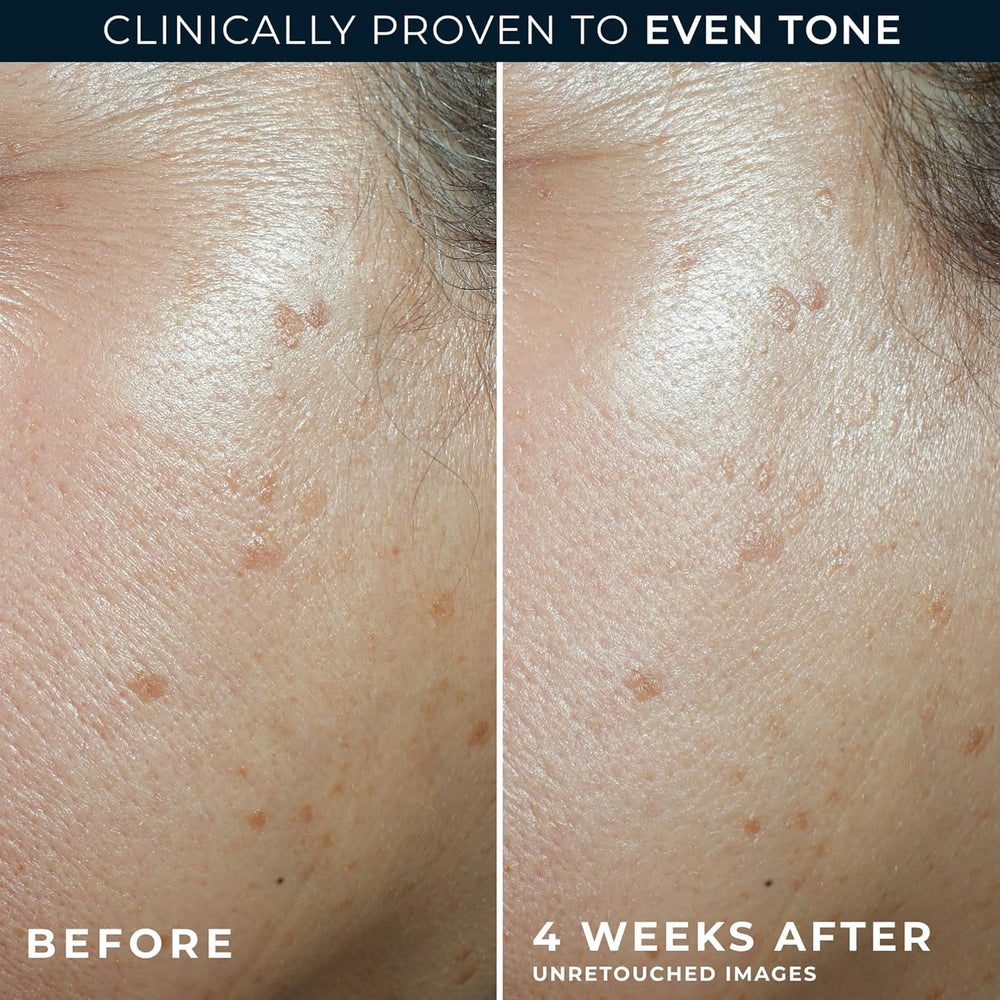 RoC Hexyl-Resorcinol complex ingredient close-up targets dark spots.