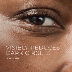 Close-up of RoC eye cream application showing creamy texture