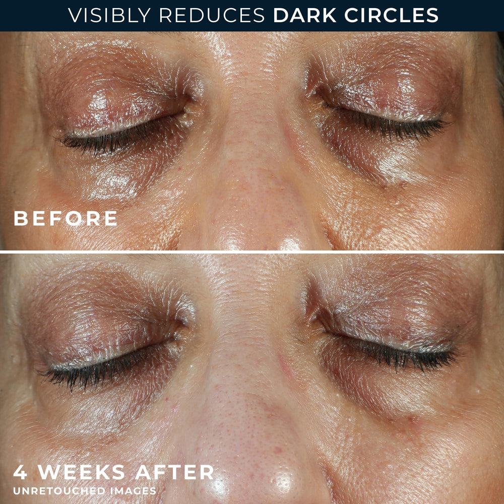 RoC eye cream packette front view for convenient evening routine