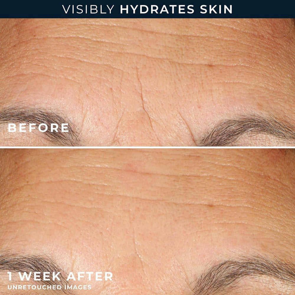 RoC Retinol Capsules applying smoothly to skin for firmer look