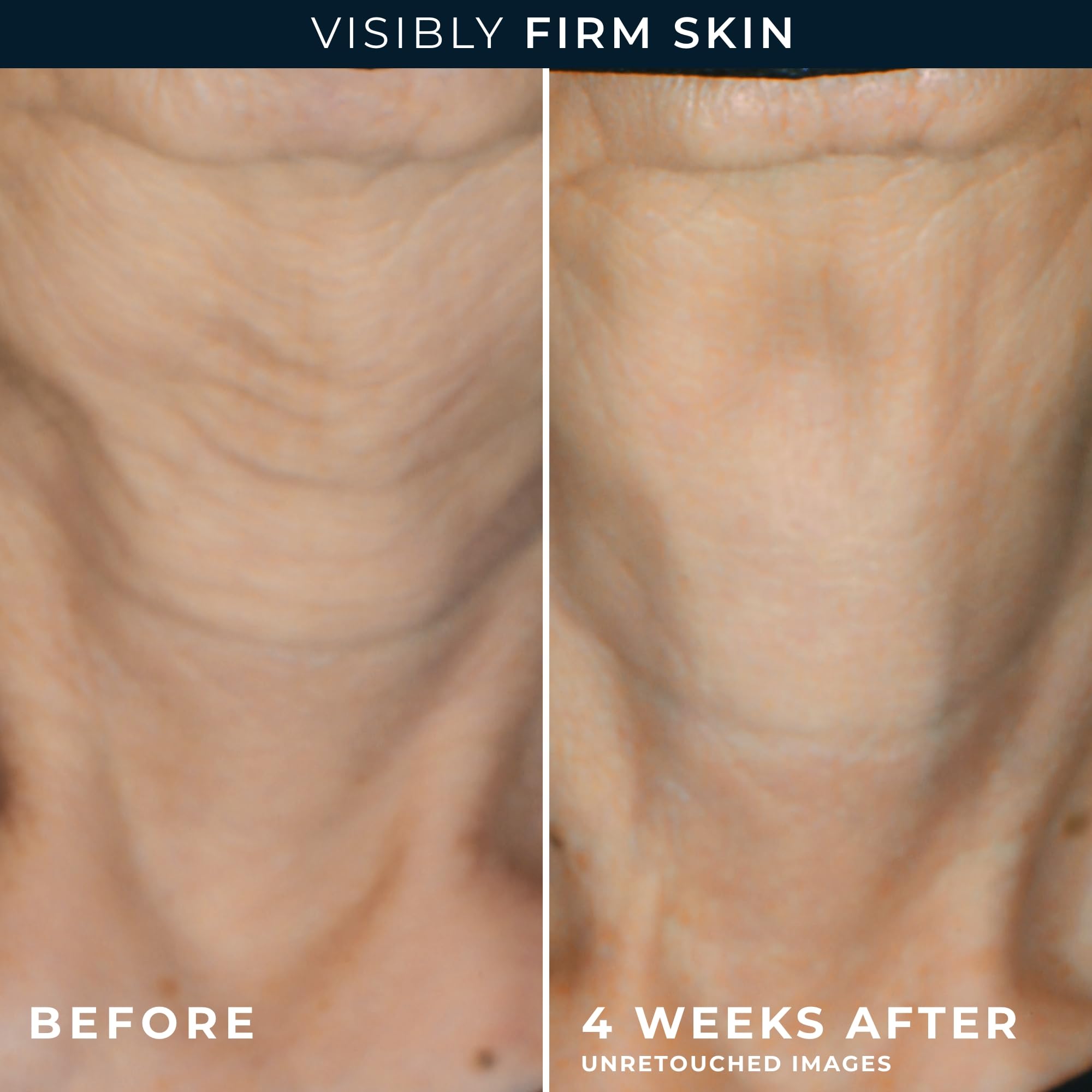 RoC Retinol capsules opened for easy nightly application and absorption.