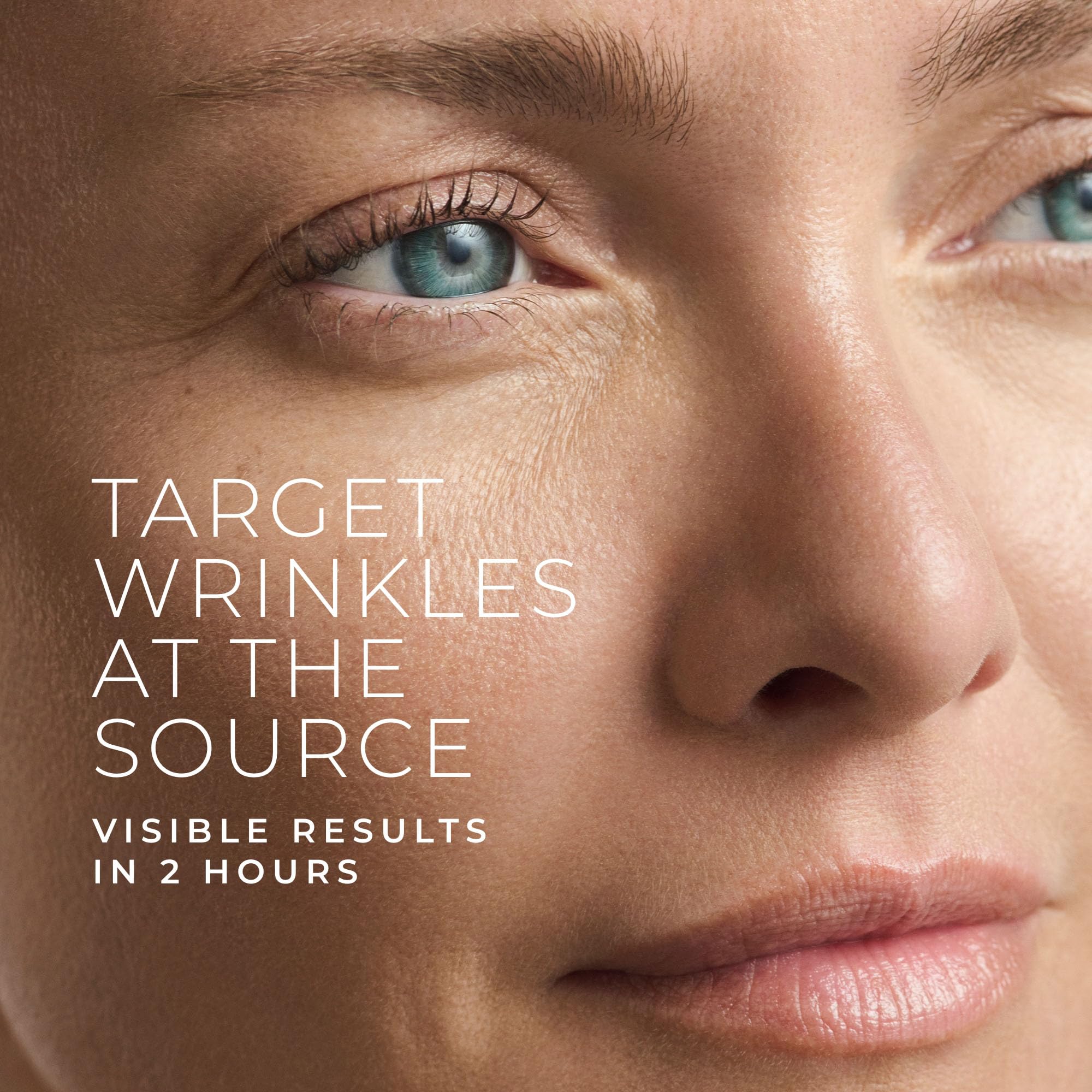 RoC patch targets crow's feet for visible improvement around the eyes