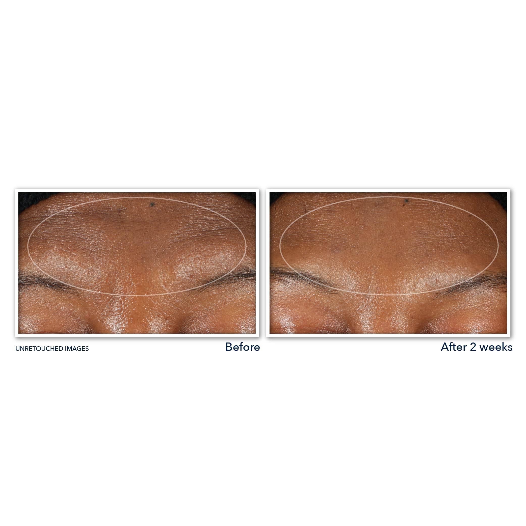 Desmaquillante RoC Retinol Correxion para rostro y ojos con maquillaje resistente