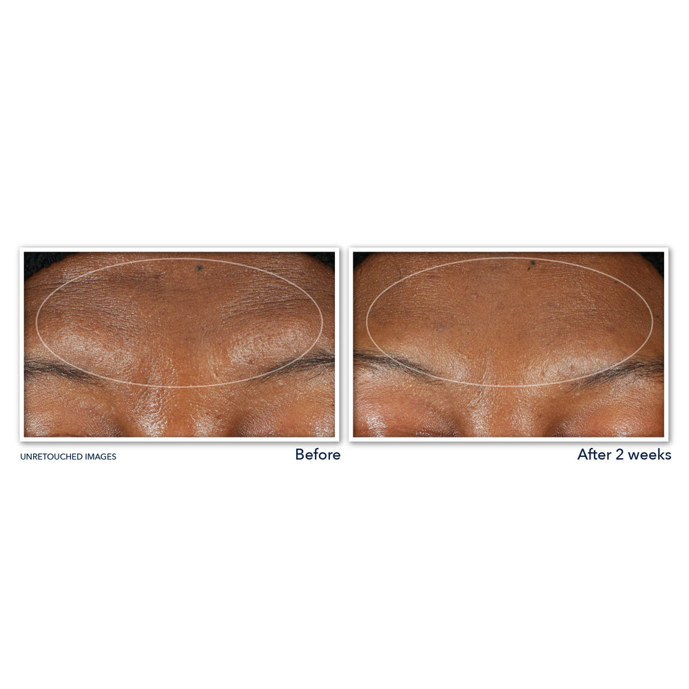 Desmaquillante RoC Retinol Correxion para rostro y ojos con maquillaje resistente