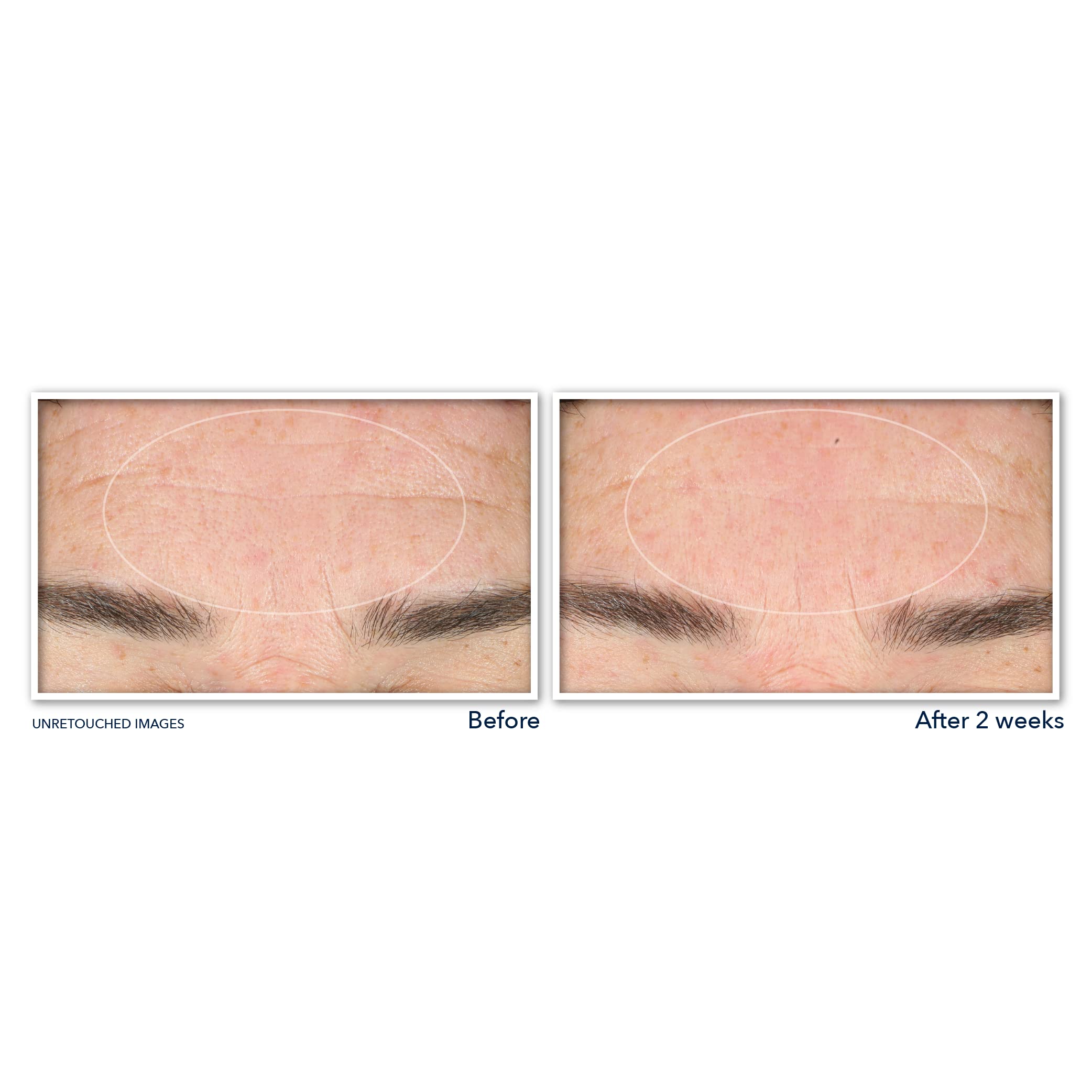 Textura cremosa del limpiador RoC Retinol Correxion para limpieza profunda