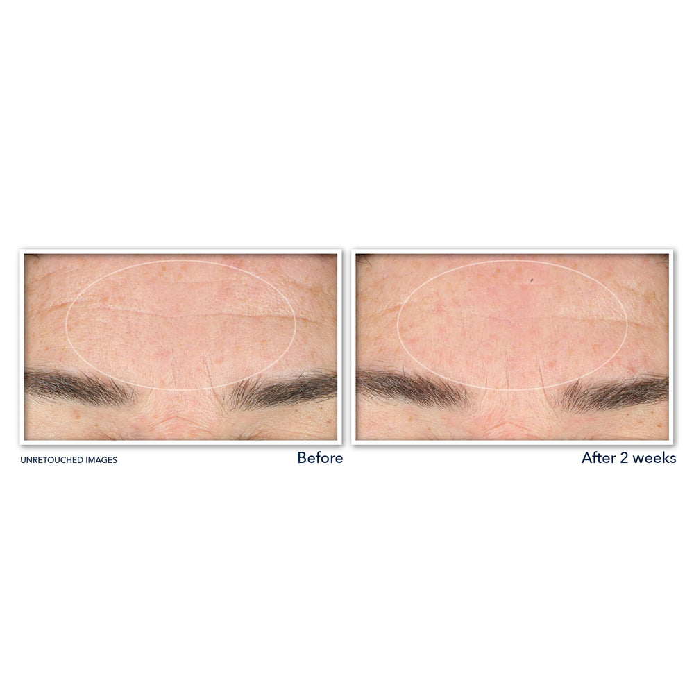 Textura cremosa del limpiador RoC Retinol Correxion para limpieza profunda