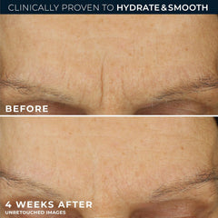 RoC Hyaluronic Acid visual highlights lasting hydration in the formula