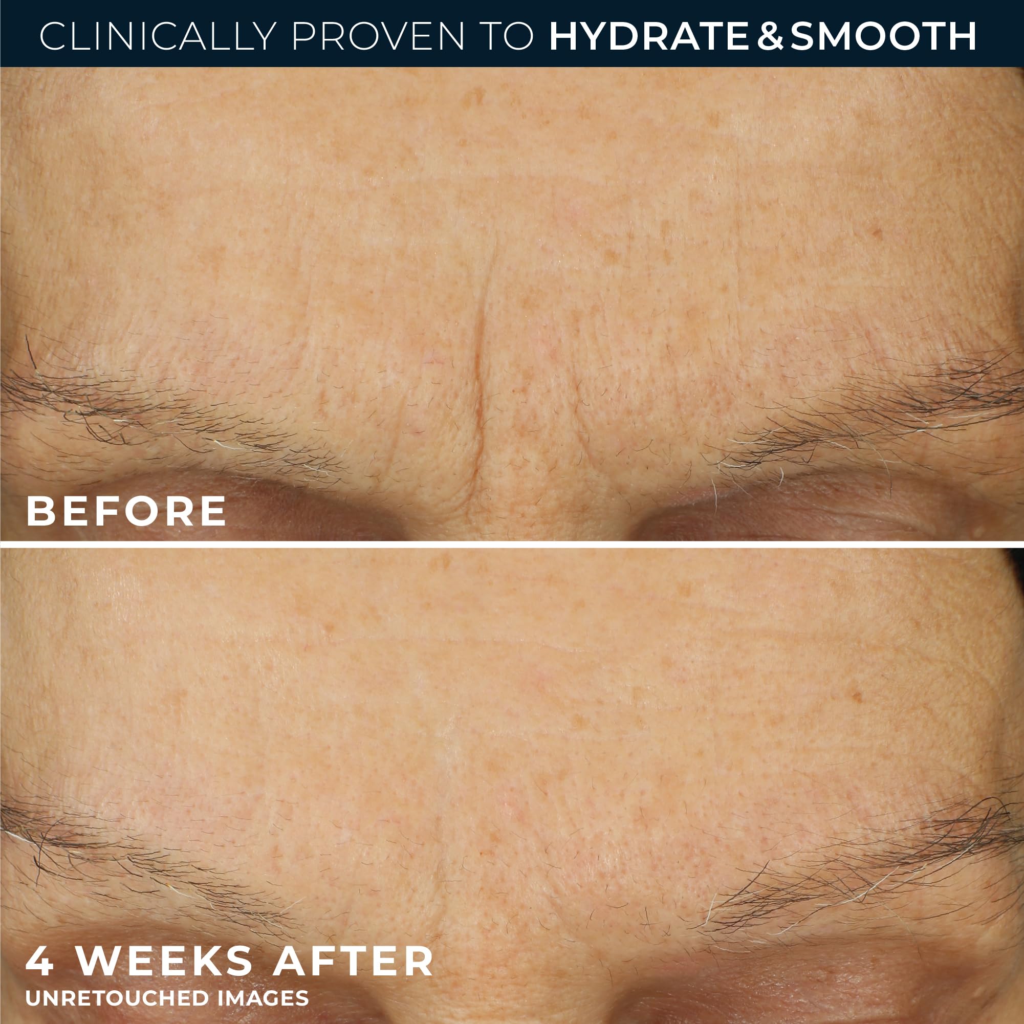 RoC Retinol Correxion Max Hydration Cream label-detail highlighting ingredients and benefits