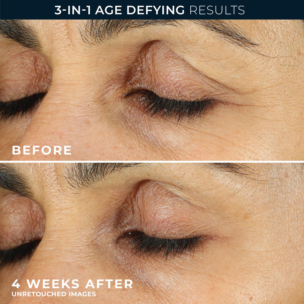 Resultados visibles en 12 semanas con RoC Retinol Correxion en el contorno ocular.
